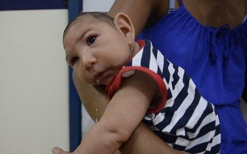 Báo động virus Zika lan rộng từ châu Phi sang châu Âu - 0 Báo động virus Zika lan rộng từ châu Phi sang châu Âu - 0