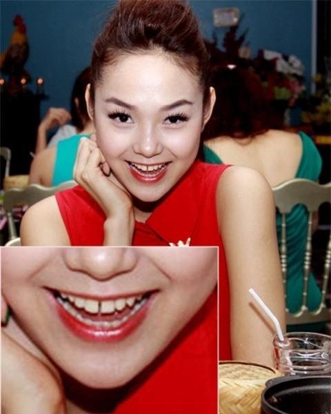Những điểm xấu không thể phẫu thuật được của các sao nữ Việt - 6