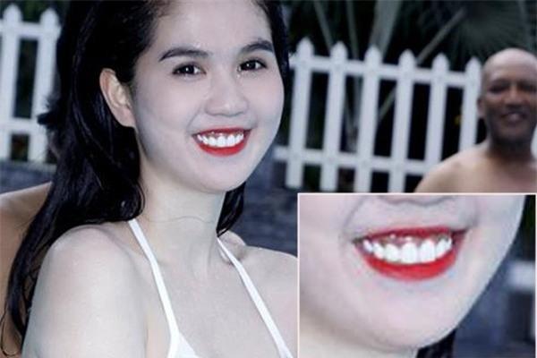 Những điểm xấu không thể phẫu thuật được của các sao nữ Việt - 7