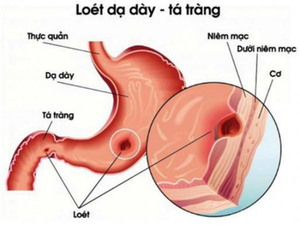 15 loại bệnh sinh ra do tức giận, xem xong không ai dám cáu gắt nữa - 2