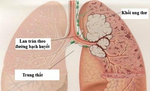 15 loại bệnh sinh ra do tức giận, xem xong không ai dám cáu gắt nữa - 4