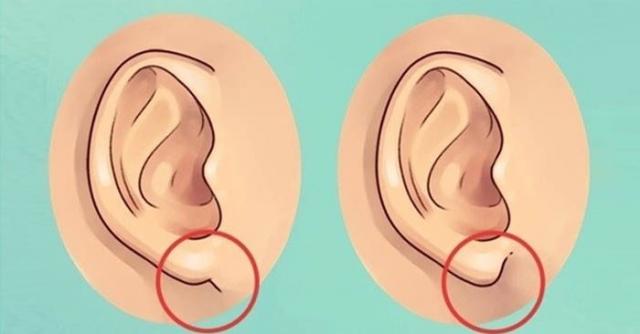  8 dấu hiệu ở tai giúp bạn chẩn đoán được bệnh trên cơ thể - 0