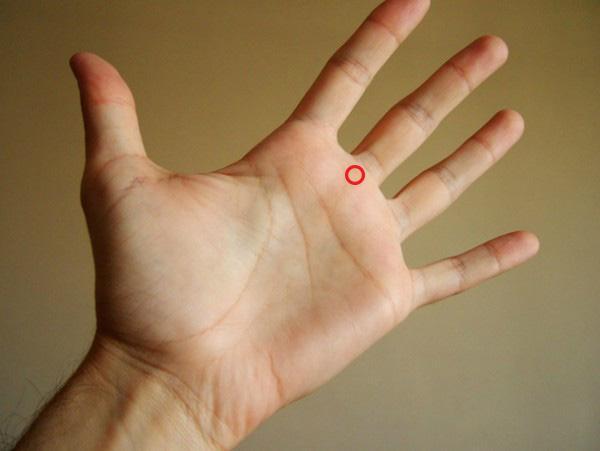 Phân biệt u lành u ác ở mũi qua khí sắc của bàn tay: Đơn giản mà chính xác đến kinh ngạc - 5