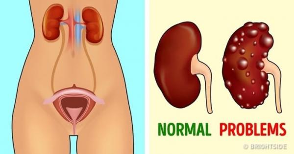 Các xét nghiệm y tế ai cũng cần làm để phòng ngừa các bệnh nghiêm trọng - 7