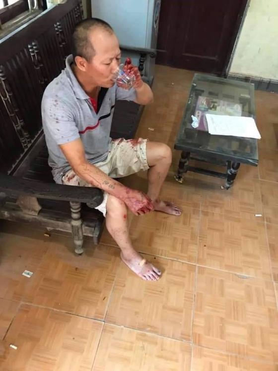 42 1 Anh Vac Dao Truy Sat Gia Dinh Em Ruot Mau Thuan 05m Dat