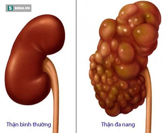 42 2 Than La Nha May Loc Nuoc Cua Co The Ai Muon Giu Than Khoe Manh Nen Lam 5 Viec