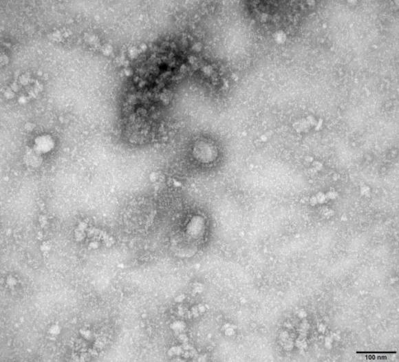 42 1 Australia Tai Tao Thanh Cong Virus Corona Trong Phong Thi Nghiem