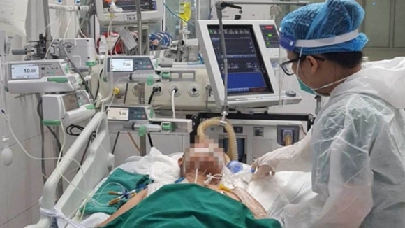 1 Sang 89 Hon 311700 Ca Mac Covid 19 Da Khoi Cuu Song San Phu F0 Suy Ho Hap Nang Phai Can Thiep Ecmo