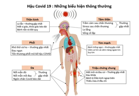 3 Khoang 50 Trieu Chung Hau Covid Tho Gap Ho Nhuc Dau Tram Cam Va Gi Nua