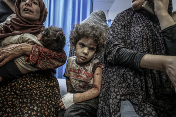1 Tre Em Gaza Chiu Ac Mong Tam Ly Duoi Mua Bom Bao Dan