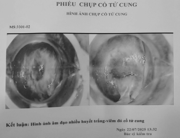 2 Phong Kham Ve Benh Moi Tien O Tphcm Luu Hinh Anh Benh Ly Bang Ky Hieu Ms