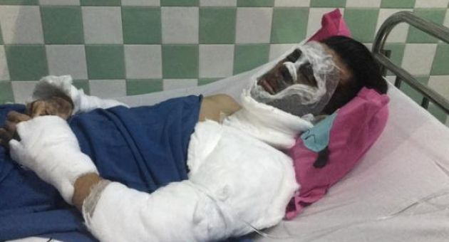 Việt kiều bị tạt a xít rồi cắt gân chân: 'Kẻ ác ra tay rất nhanh'
