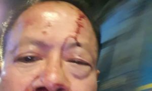 Việt Kiều Đức bị đánh trọng thương trong quán karaoke