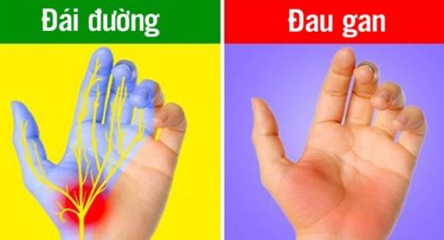 7 dấu hiệu ở bàn tay chỉ ra sức khỏe của bạn đang có vấn đề