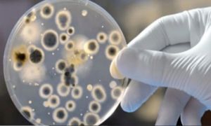 Mỹ phát hiện ca bệnh nấm nguy hiểm chết người có thể 