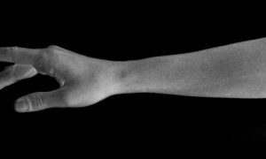 Bao giờ chúng ta đoạn tuyệt được thói quen ăn cắp?