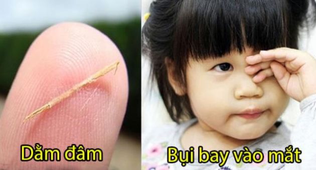 10 mẹo dân gian chữa dứt ngay bệnh vặt người Việt vẫn dùng hàng trăm năm qua