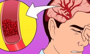 Thấy bạn bè người thân có dấu hiệu này lúc ăn cơm hãy đưa đi viện gấp, coi...