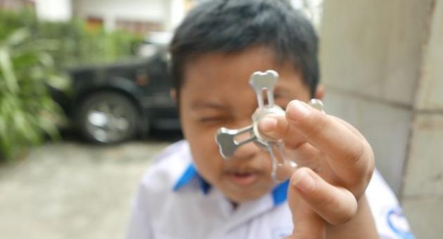 Những nguy hại khi cho trẻ chơi con quay spinner