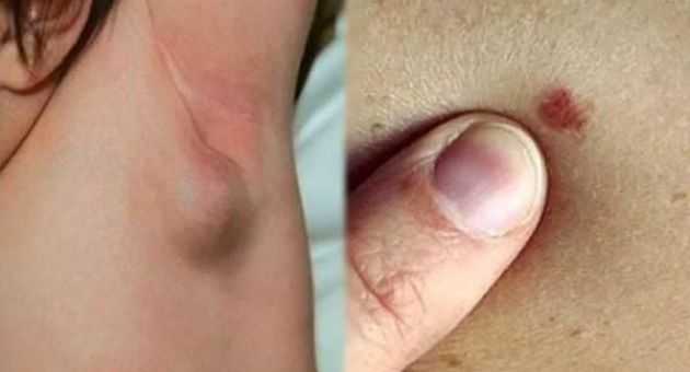 Những cảnh báo quan trọng có khi bạn đã mắc ung thư giai đoạn đầu