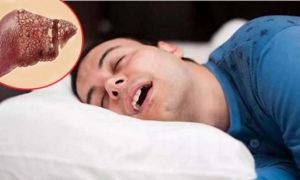 Trong khi ngủ mà xuất hiện 3 dấu hiệu này, chứng tỏ gan đang lâm bệnh, cần cứu...