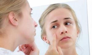 Tết lễ ăn ngủ thất thường da đen sạm, mách bạn cách đơn giản phục hồi nhanh hư...