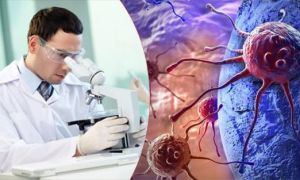 Chuyên gia Mỹ: Cách điều trị ung thư hiện nay khiến khối u ‘hung hãn’ hơn