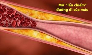 ‘Công thức vàng’ làm sạch mạch máu, giảm mỡ máu: Bài thuốc nên có trong mọi...