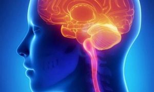 Cần biết về đột quỵ - 'kẻ giết người thầm lặng'
