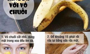 Những tác dụng kì diệu của vỏ chuối ít người biết