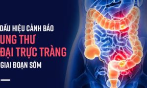 Nếu sáng ngủ dậy đau bụng hoặc có triệu chứng sau, bạn nên khẩn trương đi khám...