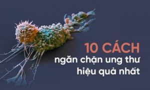 Tự cứu mình bằng 10 nguyên tắc ‘vàng’ phòng tránh ung thư