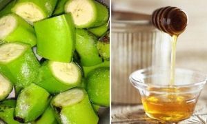 Trị dứt điểm đau dạ dày bằng chuối tiêu xanh kết hợp với mật ong