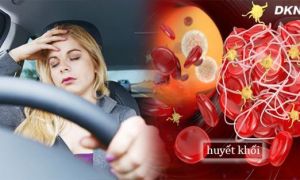 Tắc nghẽn mạch máu lặng lẽ mà nguy hiểm khôn lường, 5 kiểu người này rất dễ...