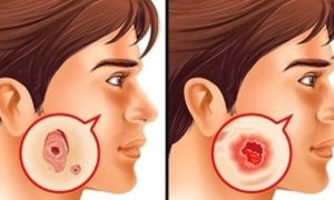 Các xét nghiệm y tế ai cũng cần làm để phòng ngừa các bệnh nghiêm trọng