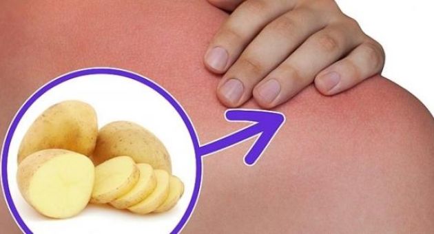 Những mẹo nhỏ từ củ khoai tây sẽ có lúc bạn dùng đến