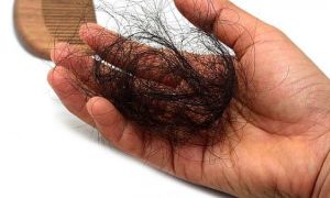 Rụng tóc, thường xuyên khát nước: Dấu hiệu cảnh báo cơ thể ‘quá tải’ đường