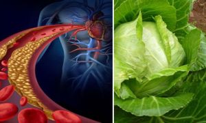 Tại sao bắp cải được ví như ‘người công nhân thu gom rác thải cho mạch máu’?