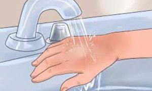 15 bài sơ cứu khi bé bị gặp nạn, mẹ nhất định phải biết để cứu con kịp thời