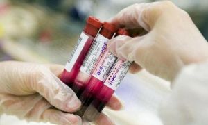 Xét nghiệm máu, biết được 8 loại ung thư