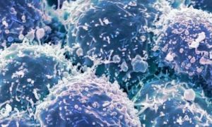 Chế tạo thành công loại virus chuyên diệt tế bào ung thư