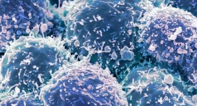 Chế tạo thành công loại virus chuyên diệt tế bào ung thư
