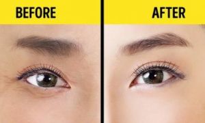 Kỹ thuật massage 1 phút tuyệt vời của Nhật Bản giúp cho đôi mắt của bạn trông...
