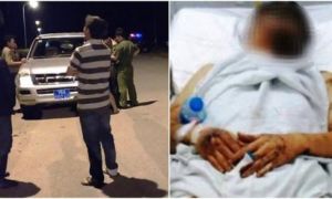Về quê ăn Tết, cặp đôi Việt Kiều bất hạnh bị tạt axit kinh hoàng
