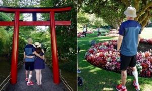 Sức khỏe của Việt kiều Canada đã tiến bộ rõ rệt sau 7 tháng bị tạt axit