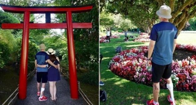 Sức khỏe của Việt kiều Canada đã tiến bộ rõ rệt sau 7 tháng bị tạt axit