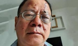 Khởi tố vụ Việt kiều Đức vô cớ bị nhóm thanh niên đánh trong quán karaoke ở...