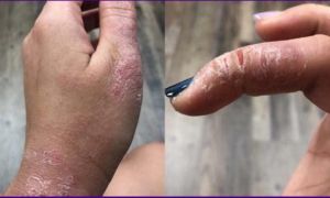 Cận cảnh đôi bàn tay nát bươm thấy thương của các thợ Nail