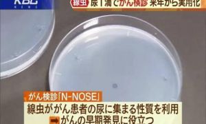 Nhật Bản: Phát hiện ung thư giai đoạn đầu chỉ bằng 1 giọt nước tiểu nhờ giun...