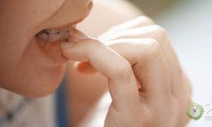Thường xuyên cắn móng tay, cô gái 20 tuổi bị cắt cụt ngón vì ung thư